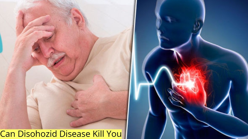 Can Disohozid Disease Kill You
